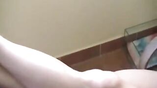 A naked girl with a cigarette was burned when she fell asleep