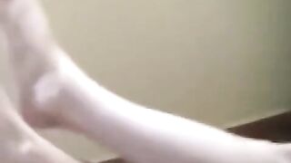 A naked girl with a cigarette was burned when she fell asleep